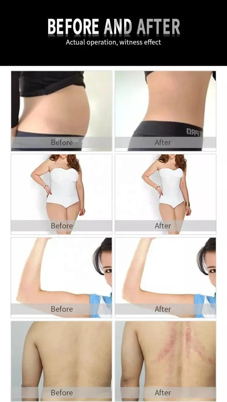 Multi-Functional 2 In 1 Release Fat Burning Skin Firming Body Shaping Negative Pressure Physiotherapy Slimming Machine Salon Spa