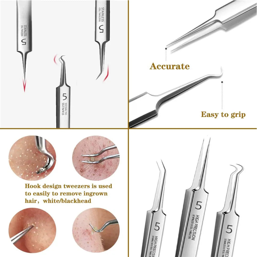 German Ultra-fine No. 5 Cell Pimples Blackhead Clip Tweezers Beauty Salon Special Scraping & Closing Artifact Acne Needle Tools